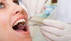 Read more about the article What is a Dental Cyst and How is it Treated?