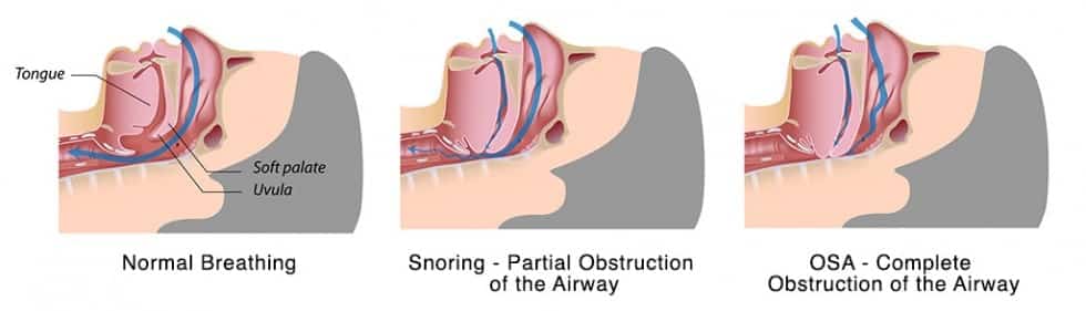 three scientific photos showing sleeping disorders